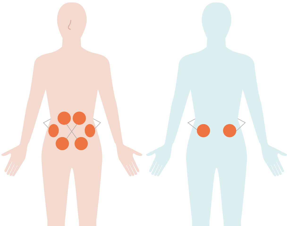 腰痛・ぽっこりお腹_イラスト