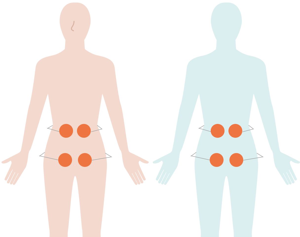 腰痛・ぽっこりお腹_イラスト