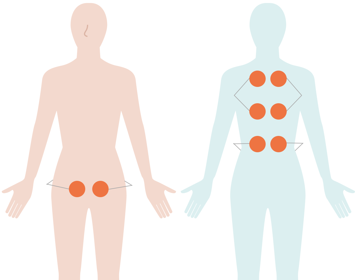 腰痛・ぽっこりお腹_イラスト