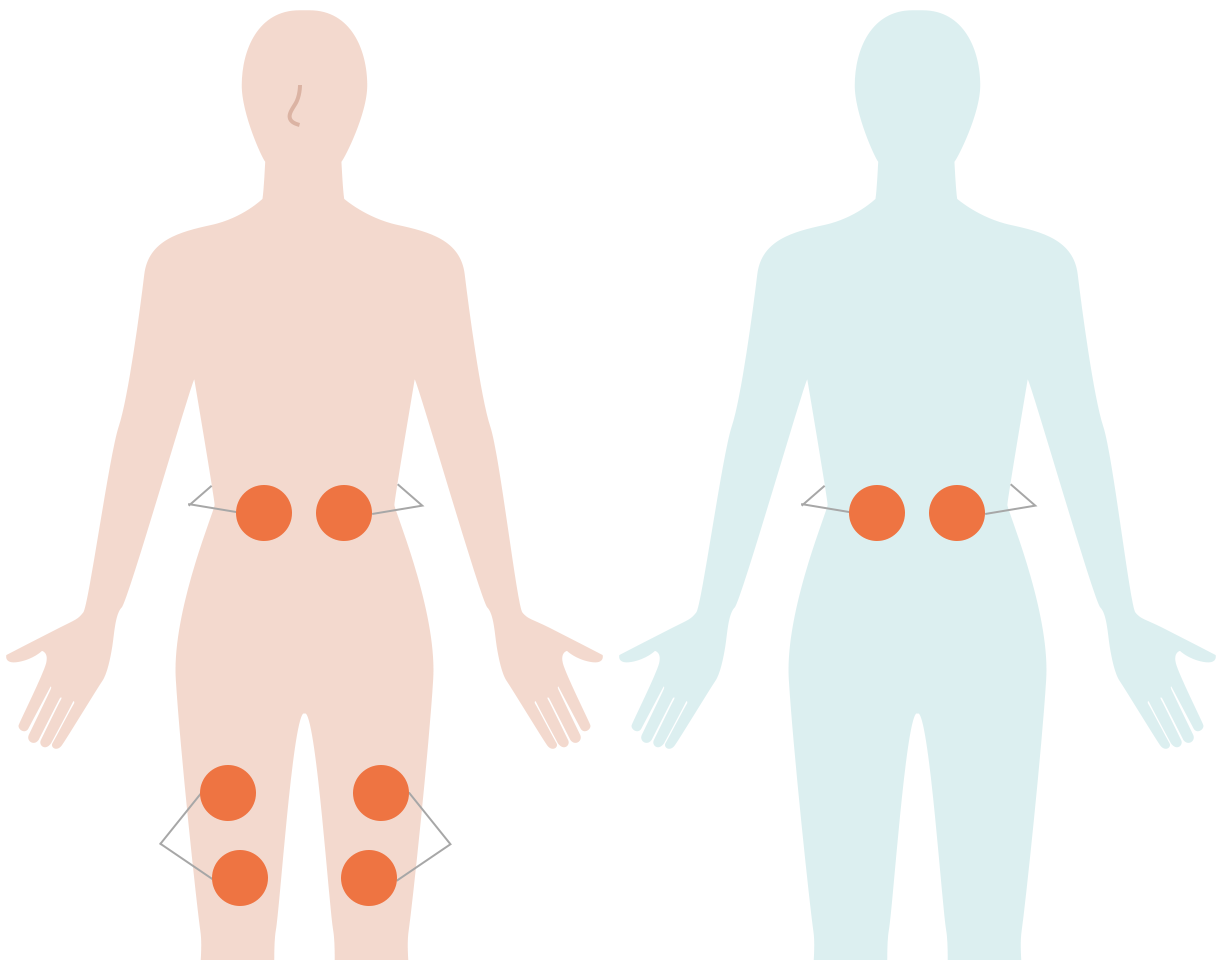 腰痛・ぽっこりお腹_イラスト